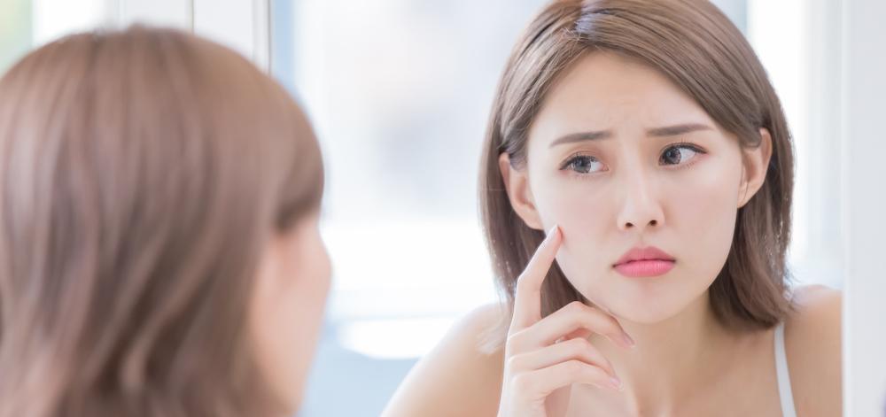 Need help with managing your acne breakouts? We speak to an expert for some simple tips.